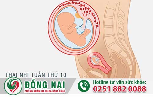 10 Tuần Phá Thai Ở Đâu Uy Tín Tại Biên Hòa,  Tư Vấn Phá Thai Miễn Phí