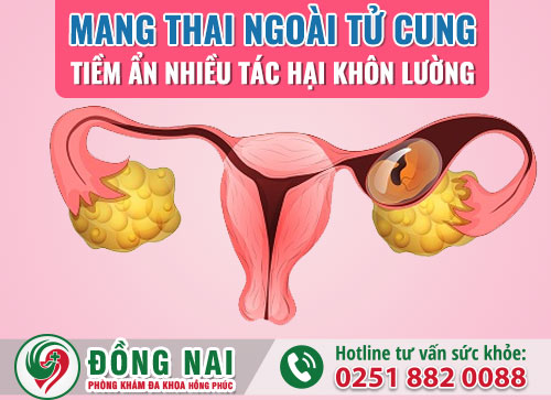 Mang thai ngoài tử cung nguy hiểm như thế nào?