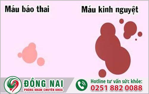 Máu Báo Có Thai Và Giải Quyết Ở Đâu Khi Thai Ngoài Ý Muốn Uy Tín