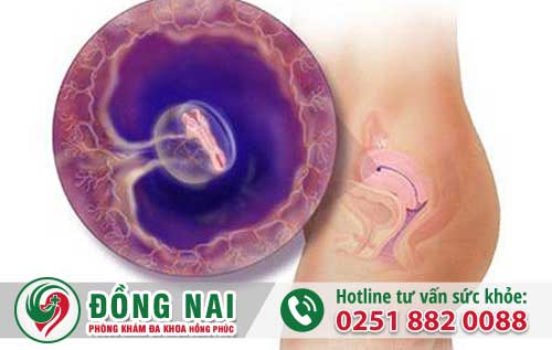 Phá Thai 1 Tuần Tuổi Bằng Thuốc Có Được Không?