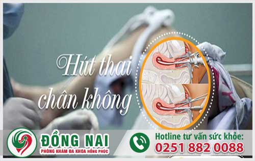Phương pháp phá thai ngoài ý muốn an toàn hiệu quả hiện nay là gì?