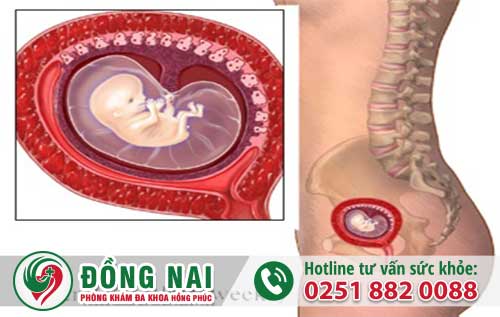 Thai 2 Tháng Tuổi Nên Phá Bằng Phương Pháp NÀo Là An Toàn? Tư Vấn Phá Thai Miễn Phí